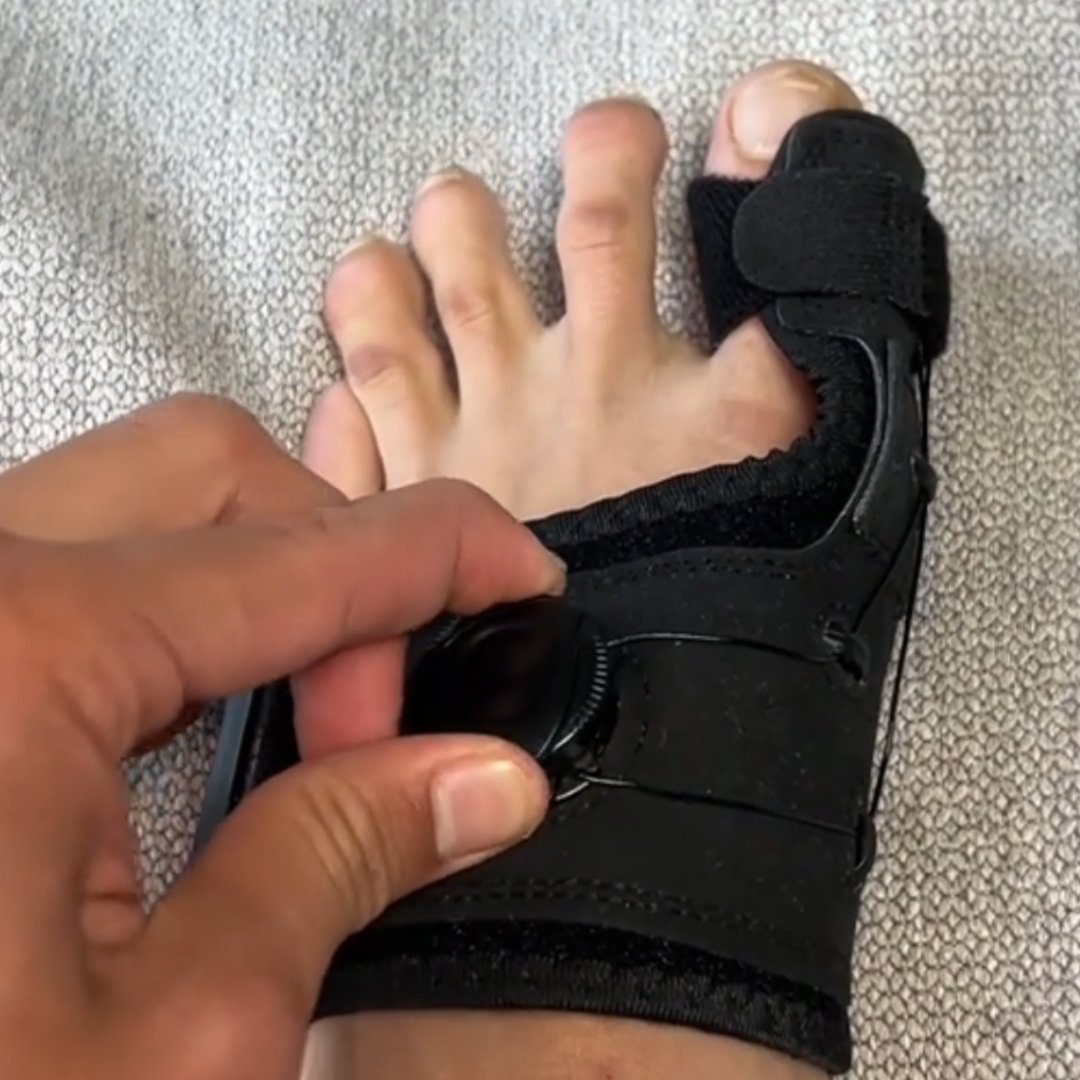 Zorveko Adjustable Bunion Toe Corrector testimonials_HYFz9F:image:0