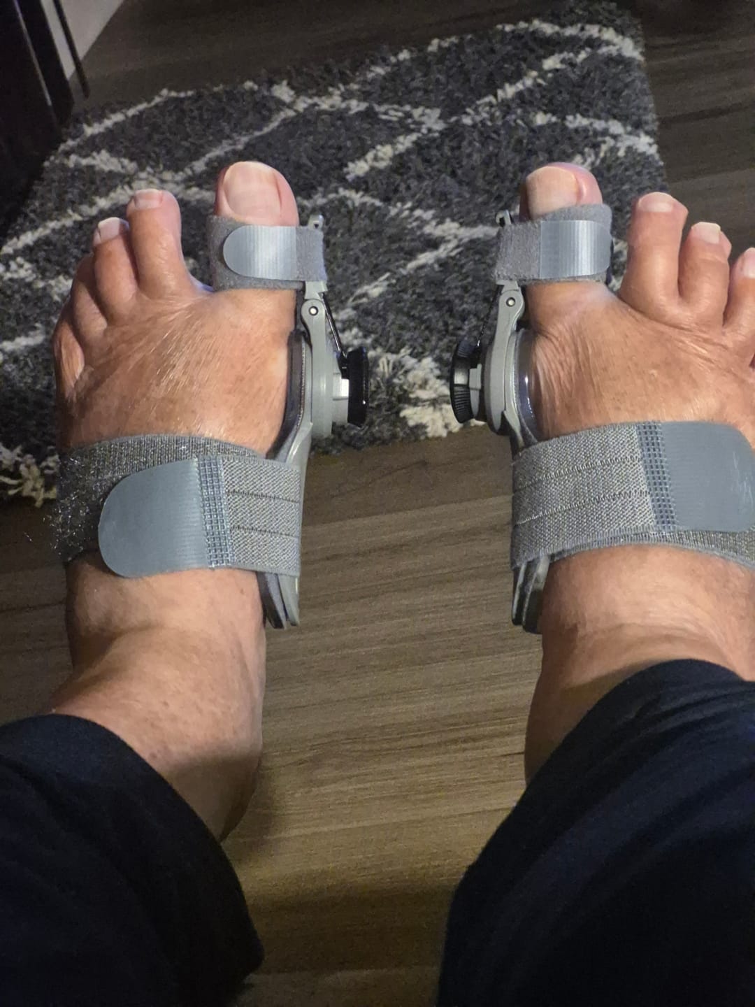 Zorveko Bunion Corrector – Adjustable Toe Alignment Support for Daily Comfort image_slider_biYJhD:image:2