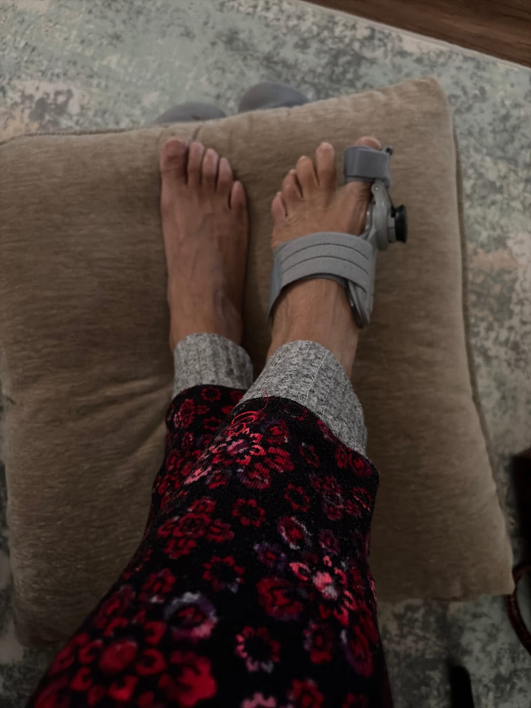 Zorveko Bunion Corrector – Adjustable Toe Alignment Support for Daily Comfort image_slider_biYJhD:image:1