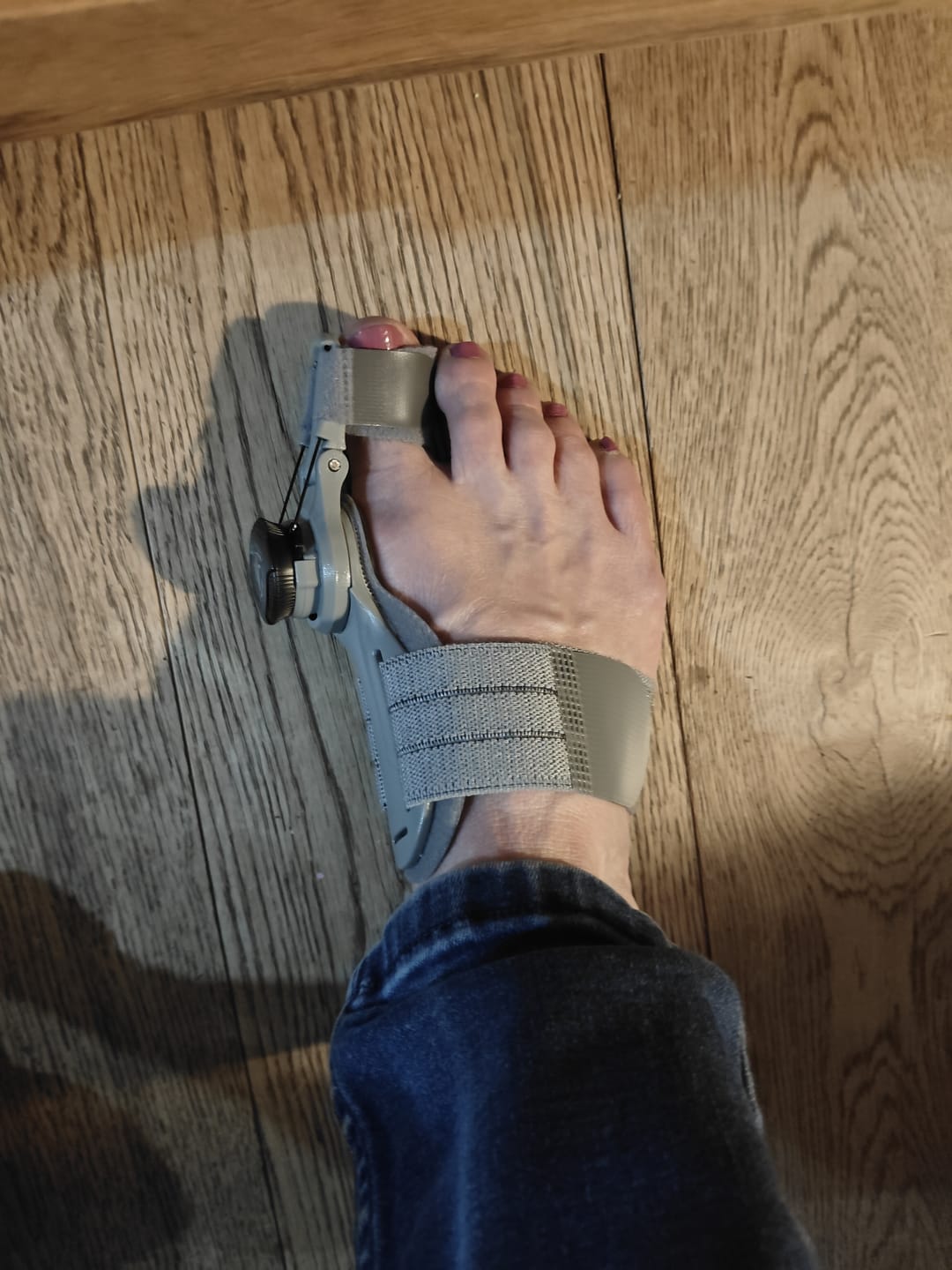 Zorveko Bunion Corrector – Adjustable Toe Alignment Support for Daily Comfort image_slider_biYJhD:image:0