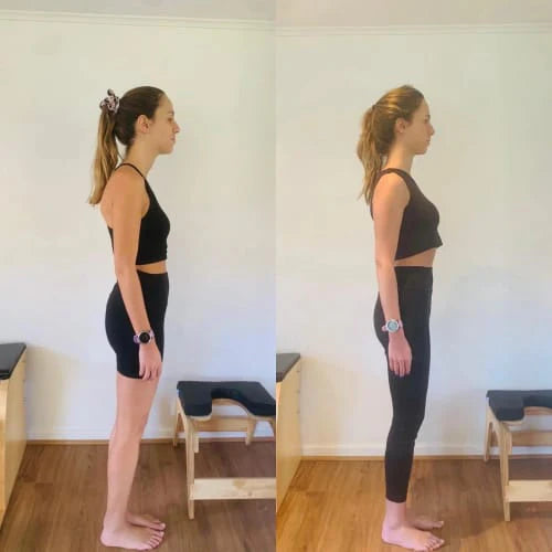 Zorveko Instant Posture Corrector testimonials_HYFz9F:image:1