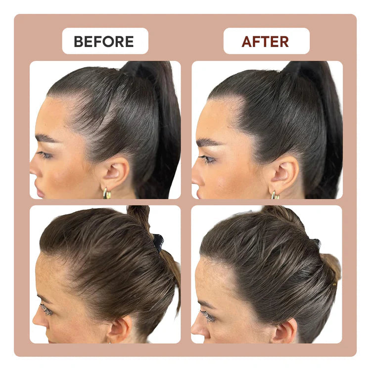 Zorveko Root and Scalp Touch-Up Spray image_with_text_AWxa8i:image:0