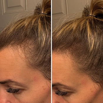 Zorveko Root and Scalp Touch-Up Spray testimonials_TNmfY4:image:2