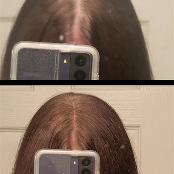 Zorveko Root and Scalp Touch-Up Spray testimonials_TNmfY4:image:1